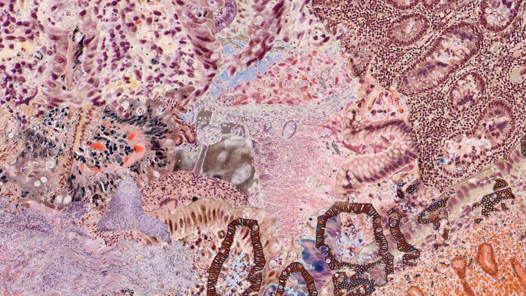 Stomach Ache Amelia Hine. Moving image artwork commissioned for the Stomach Ache website (2022)